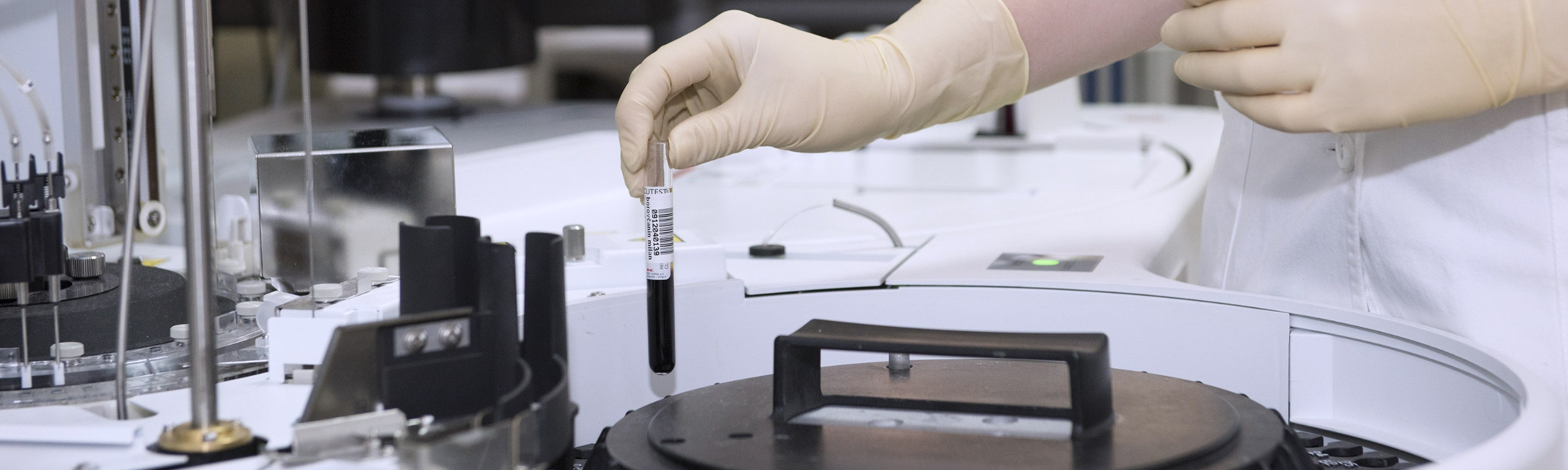 A hand holding a test tube